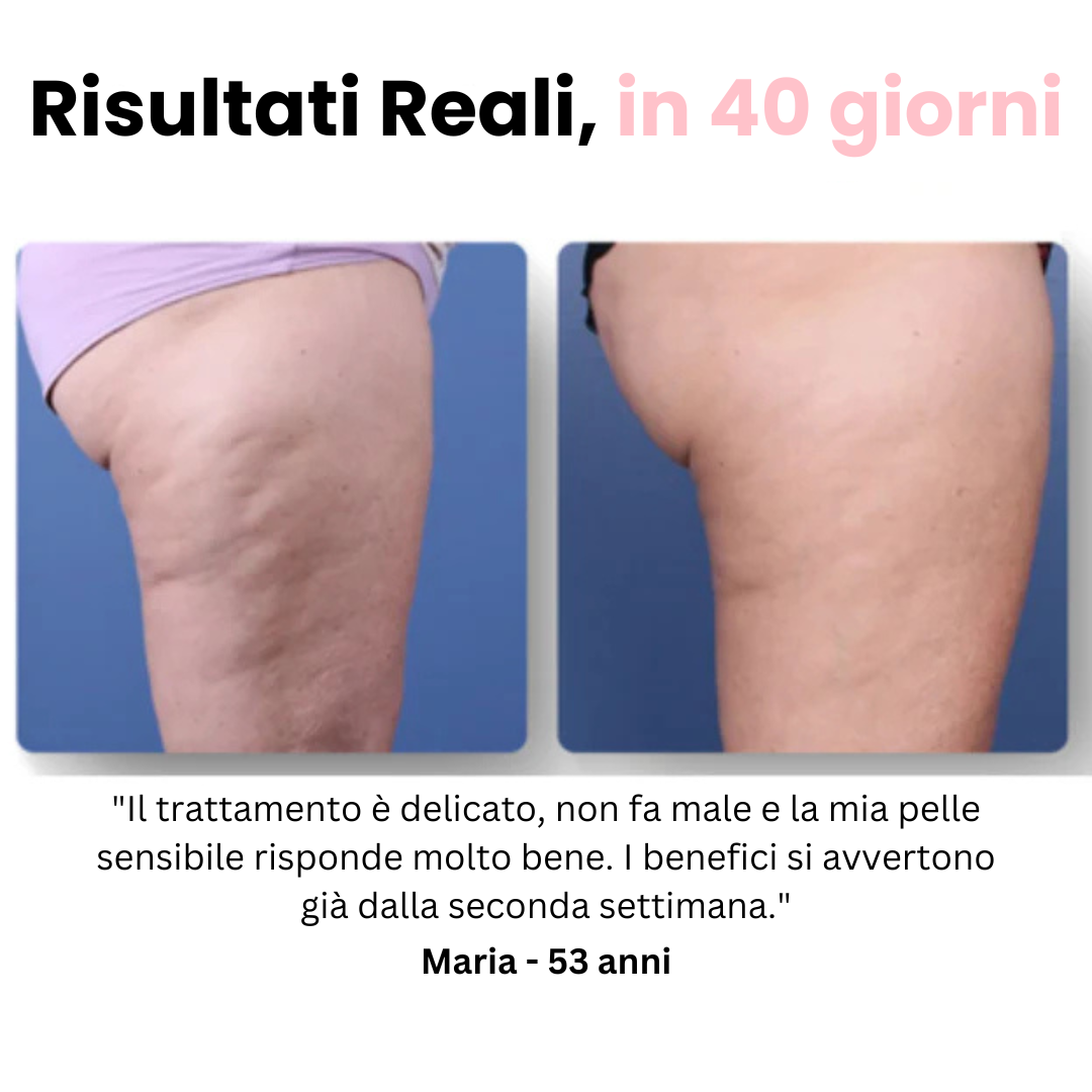 Velora™ - Massaggiatore