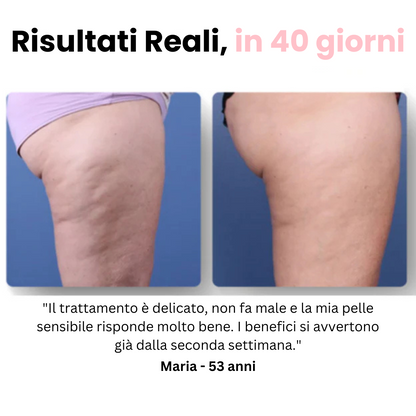 Velora™ - Massaggiatore