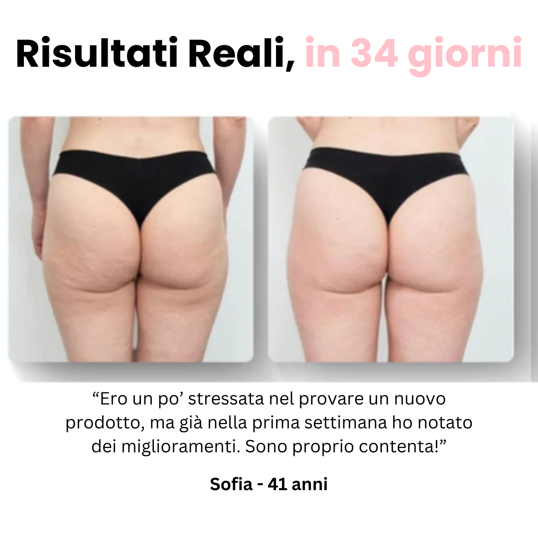 Velora™ - Massaggiatore